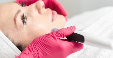 Microneedling Gesicht