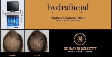 wunderHAAR - Keravive&trade; by HydraFacial&trade;