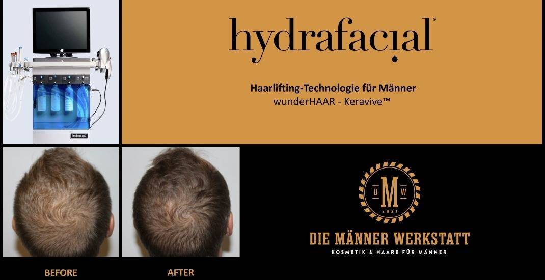 wunderHAAR - Keravive™ by HydraFacial™
